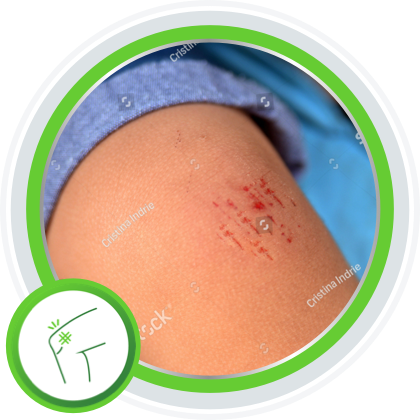 Understand Minor Wounds